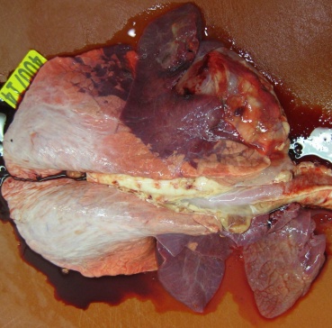 Lung showing damage due to pneumonia - note dark patches of necrotic tissue